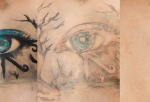 Entfernung eines Tattoos